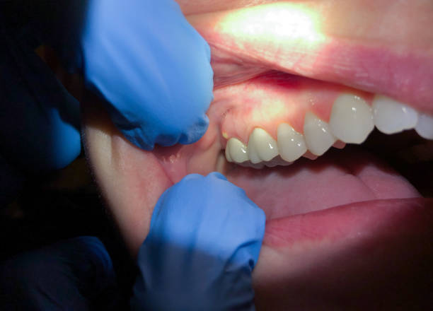 Best Pediatric Emergency Dentist in Madras, OR